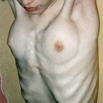 Second pic of Skinny Beauties - The skinniest girls on the web!