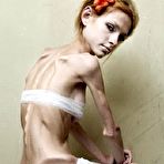 Third pic of Skinny Beauties - The skinniest girls on the web!