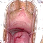 Third pic of ITC Crack-Assets - 264