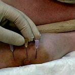 Second pic of Fun with Needles