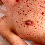 Second pic of Free teen girl photos TeenNudistXL.com