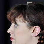 Fourth pic of Facial Needle Pain