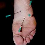 Third pic of Amateur Needle Pain