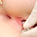Second pic of Gyno exam