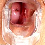 Fourth pic of Kira speculum examination by kinky gyno doctor at his kinky clinic