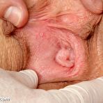 Second pic of Ester gyno fetish pussy speculum examination by old doctor