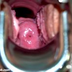 Fourth pic of Iveta pussy speculum wide stretching during gyno exam at gyno clinic