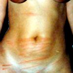 Third pic of PAINRISER - Masochism Website!