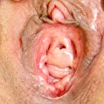 Second pic of Sofie very old nurse pussy speculum masturbation