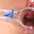 Second pic of 18closeup.com: Teen Enjoys an Orgasm While her Vagina Stretched #Exploration #Speculum #Orgasm