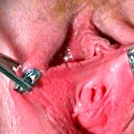 Second pic of Top Pain (toppain)