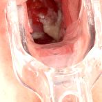 Third pic of ExclusiveClub.com | Doctor's Office Presents Helga