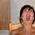 Fourth pic of Japanese Needle Pain