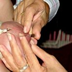 Second pic of Amateur Needle Pain