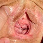 Fourth pic of Janelle gyno fetish pussy speculum examination at gyno clinic