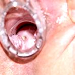 Fourth pic of Rosana older naughty nurse vag masturbation at gyno clinic with gyn mirror and plastic schlong