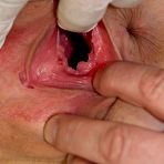 Third pic of Kristyna gyno beaver gynecological tool inspection on gynochair at weird clinic