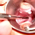 Second pic of FREE TORTURE GALLERY