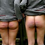 Fourth pic of LUPUS SPANKING - free spanking on BDSMBook.com
