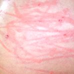 Third pic of SexPreviews - Nadia White is bound with tits exposed and mouth spread wide