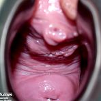 Fourth pic of Blond girl next door Tina treated by kinky gyno doctor