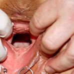 Second pic of Gray professor gyno vagina exam with speculum gray mamma at gyno clinic
