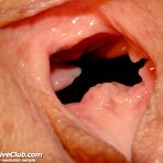 Third pic of ExclusiveClub.com -&nbsp;Gorgeous Janelle treated by kinky gyno doctor