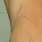 Second pic of CLITOR PUSSY TORTURE