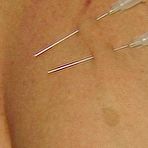 Third pic of CLITOR PUSSY TORTURE