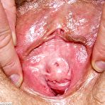 Second pic of Radka old aged nurse cooter masturbation at gyno clinic with speculum and penis toy