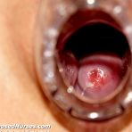 Third pic of Filthy nurse Zaneta masturbating with big vibrator and gyn instrument at gyno clinic