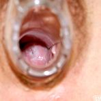 Fourth pic of Weird nurse Viktorie masturbating with big fake cock and vaginal speculum at gyno clinic