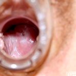 Fourth pic of Knky nurse uniform Viktorie fuck hole spreading with gyno tools