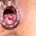 Fourth pic of Venuse aged nurse minge gyn instrument gaping