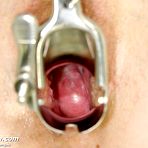 Fourth pic of Mila  mature old nurse hole latex cock masturbation on gynochair