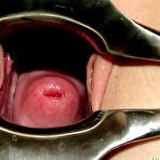 Third pic of Chubby Nia gyno clinic speculum pussy examination