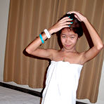 Third pic of Teen with Braces