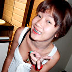 Fourth pic of Teen with Braces