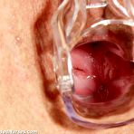 Fourth pic of Mind-blowing nurse porn Sharon nurse spreads puss with expander
