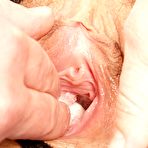 Second pic of Katie cooter exam with pussy spreader and other gyno tools