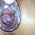 Fourth pic of Evelyn  very experienced gyno vagina pussy spreader inspection