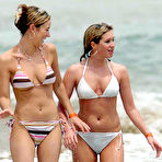 First pic of Brooke Kinsella looking sexy in bikini