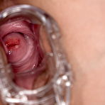 Fourth pic of Angel Wicky in sexy lingerie and stockings inserts a speculum