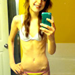 First pic of Anorexic Selfies (10 pics)