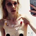 Second pic of Anorexic Selfies (10 pics)