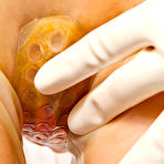 Third pic of Clinical Torments