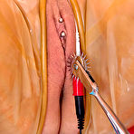 Second pic of Clinical Torments
