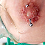 Second pic of Clinical Torments