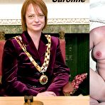 Fourth pic of Mature Amateurs, Dressed & Undressed 3 - 18 Pics | xHamster