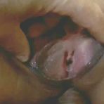 Second pic of Anal Sex-Mature Wife-Wide-spread Big Meaty Cunt - AmateurPorn